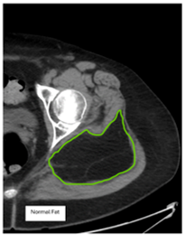 ALT Figure 1